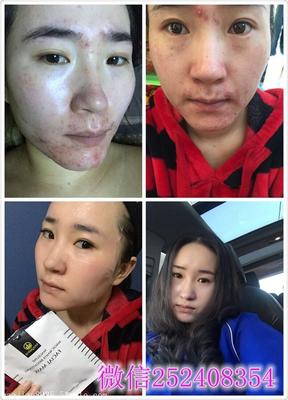 麥吉麗素顏三部曲效果與代理政策詳解